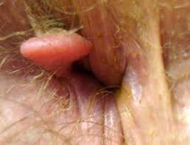 Dr.Kashid Hospital & Piles Clinic